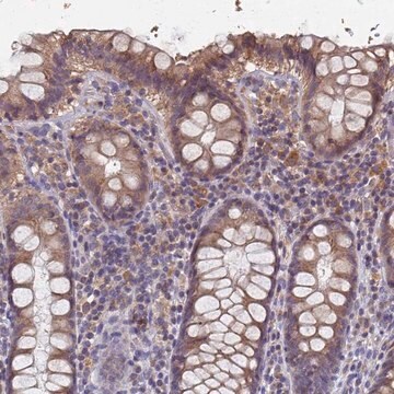 Anti-KRCC1 antibody produced in rabbit Prestige Antibodies&#174; Powered by Atlas Antibodies, affinity isolated antibody, buffered aqueous glycerol solution