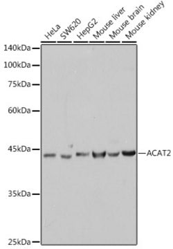 Anti-ACAT2 Antibody, clone 6Z5L1, Rabbit Monoclonal