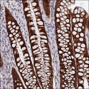 Anti-KATNAL1 antibody produced in rabbit Prestige Antibodies&#174; Powered by Atlas Antibodies, affinity isolated antibody, buffered aqueous glycerol solution