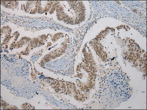 Anti-SERPINB8 affinity isolated antibody