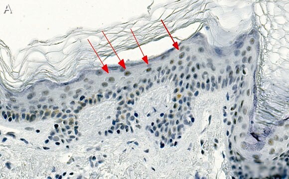 Anti-CBX2 Antibody, clone 3I14 ZooMAb&#174; Rabbit Monoclonal recombinant, expressed in HEK 293 cells