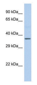 Anti-CYTB (C-terminal) antibody produced in rabbit affinity isolated antibody