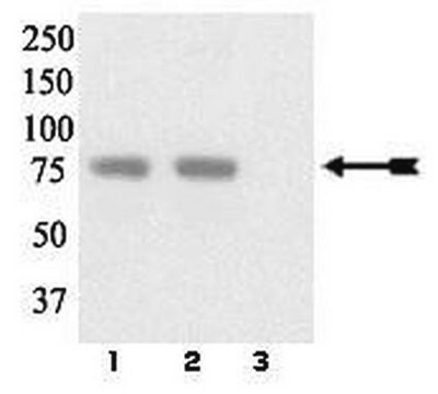 Anticuerpo anti-fosfo-LIMK 1/2 (Tyr507/Thr508) Upstate&#174;, from rabbit