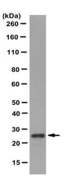 Anti-Sigma-IR-Antikörper, Klon&nbsp;ICR-SIG1R-A clone ICR-SIG1R-A, from rat