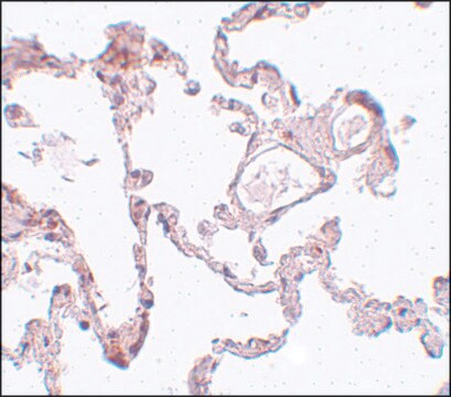 Anti-PLEKHM1 antibody produced in rabbit affinity isolated antibody, buffered aqueous solution