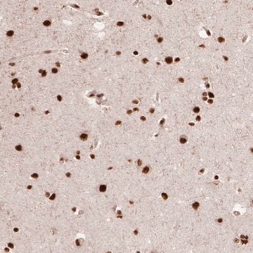 Anti-PPIG antibody produced in rabbit Prestige Antibodies&#174; Powered by Atlas Antibodies, affinity isolated antibody, buffered aqueous glycerol solution