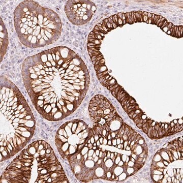 Anti-TRIM73 antibody produced in rabbit Prestige Antibodies&#174; Powered by Atlas Antibodies, affinity isolated antibody, buffered aqueous glycerol solution