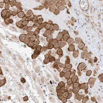 Anti-IL36B antibody produced in rabbit Prestige Antibodies&#174; Powered by Atlas Antibodies, affinity isolated antibody, buffered aqueous glycerol solution