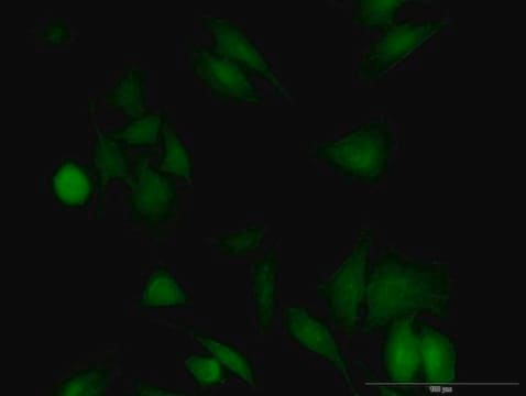 Monoclonal Anti-UBE2G1 antibody produced in mouse clone 2A9-1F11, purified immunoglobulin, buffered aqueous solution