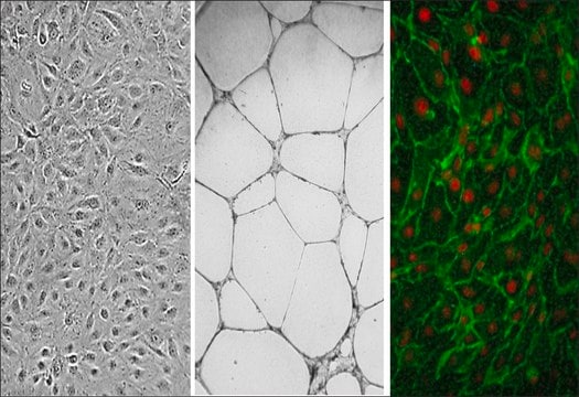 Human Dermal Microvascular Endothelial Cells: CADMEC/HMVEC, neonatal