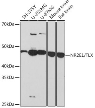 Anti-NR2E1/TLX Antibody, clone 6P3H8, Rabbit Monoclonal