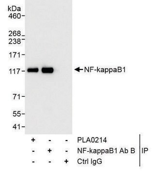 Rabbit anti-NF-kappaB1 Antibody, Affinity Purified Powered by Bethyl Laboratories, Inc.