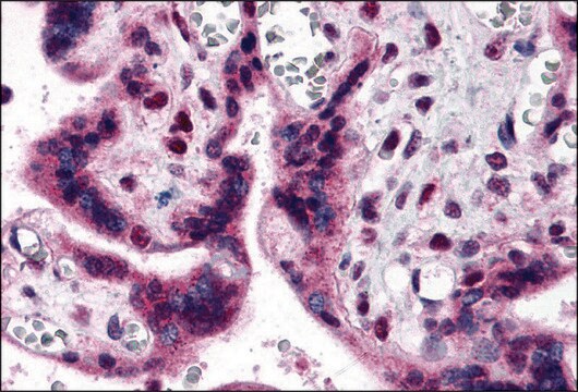 Anti-IRF2BP2 antibody produced in rabbit affinity isolated antibody