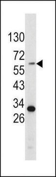 ANTI-TYROSINASE(C-TERMINAL) antibody produced in rabbit purified immunoglobulin, buffered aqueous solution