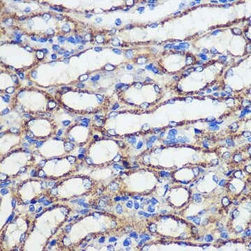 Anti- SND1 antibody produced in rabbit