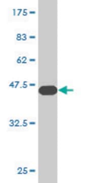 Monoclonal Anti-CGB5 antibody produced in mouse clone 2E7, purified immunoglobulin, buffered aqueous solution