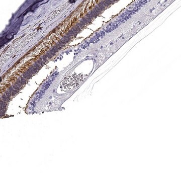 Anti-GNGT1 antibody produced in rabbit Prestige Antibodies&#174; Powered by Atlas Antibodies, affinity isolated antibody, buffered aqueous glycerol solution