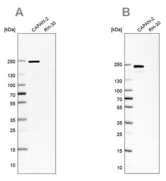 Anti-ITGB4 antibody produced in rabbit Prestige Antibodies&#174; Powered by Atlas Antibodies, affinity isolated antibody, buffered aqueous glycerol solution