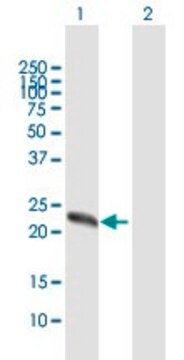 Anti-ZCCHC4 antibody produced in mouse purified immunoglobulin, buffered aqueous solution