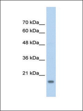 Anti-AMFR antibody produced in rabbit IgG fraction of antiserum