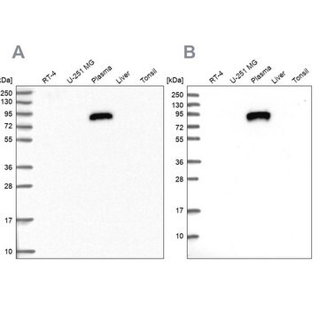 Anti-IGFALS antibody produced in rabbit Prestige Antibodies&#174; Powered by Atlas Antibodies, affinity isolated antibody, buffered aqueous glycerol solution