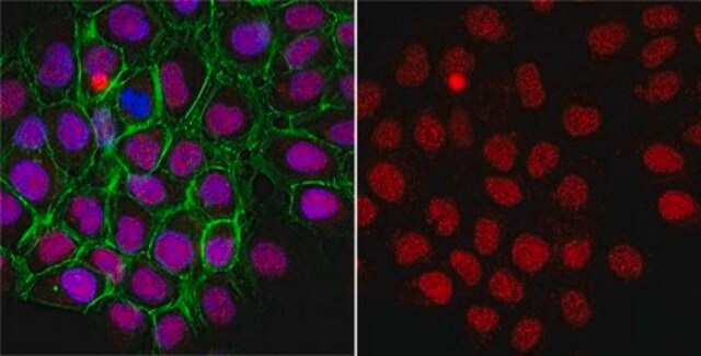 Anti-Thymine-DNA Glycosylase Antibody from rabbit, purified by affinity chromatography