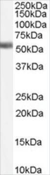 Anti-Farnesoid X Receptor/HRR1 antibody produced in goat affinity isolated antibody, buffered aqueous solution