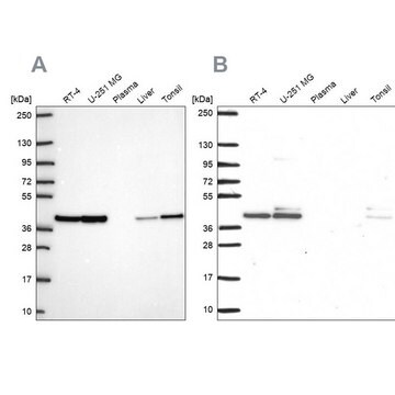 Anti-STRAP antibody produced in rabbit Prestige Antibodies&#174; Powered by Atlas Antibodies, affinity isolated antibody