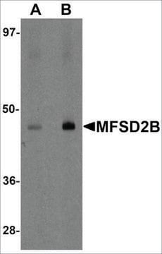 Anti-MFSD2B antibody produced in rabbit affinity isolated antibody, buffered aqueous solution