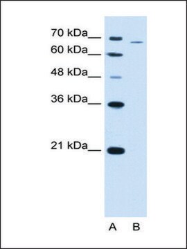 Anti-PFKL antibody produced in rabbit IgG fraction of antiserum