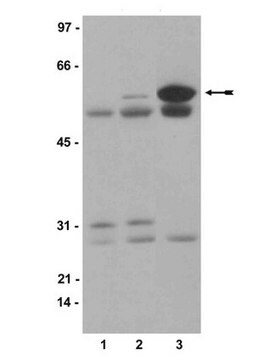 Anti-phospho-Src (Tyr416) Antikörper, Klon 9A6 clone 9A6, Upstate&#174;, from mouse