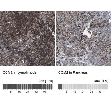 抗CCM2抗体 ウサギ宿主抗体 Prestige Antibodies&#174; Powered by Atlas Antibodies, affinity isolated antibody, buffered aqueous glycerol solution, Ab1