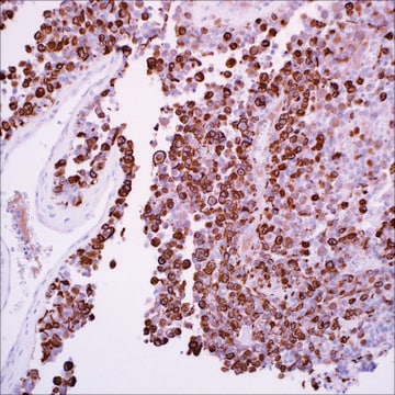 Neurofilament (EP79) Rabbit Monoclonal Primary Antibody