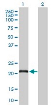 Anti-DCAKD antibody produced in rabbit purified immunoglobulin, buffered aqueous solution