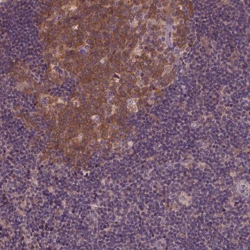 Anti-KBTBD8 antibody produced in rabbit Prestige Antibodies&#174; Powered by Atlas Antibodies, affinity isolated antibody