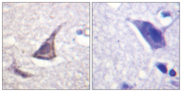 Anti-C/EBP-&#949; antibody produced in rabbit affinity isolated antibody