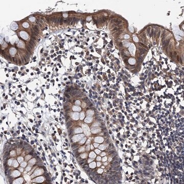 Anti-NAA16 antibody produced in rabbit Prestige Antibodies&#174; Powered by Atlas Antibodies, affinity isolated antibody, buffered aqueous glycerol solution