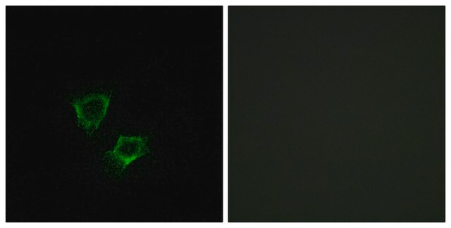 Anti-ZNRF2 antibody produced in rabbit affinity isolated antibody