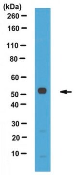 Przeciwciało przeciwko perylipinie-3, koniec C from rabbit, purified by affinity chromatography