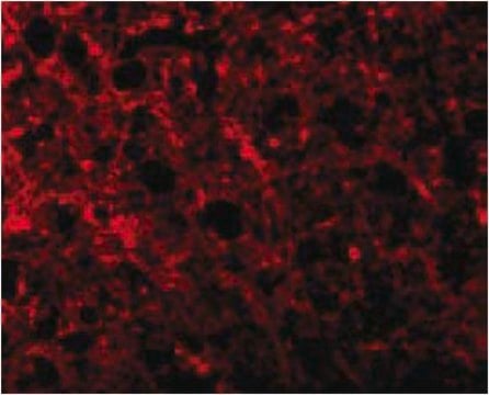 Anti-ATR Antibody from rabbit, purified by affinity chromatography