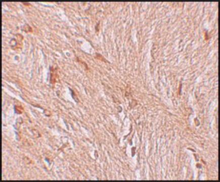 Anti-ZBTB3 antibody produced in rabbit affinity isolated antibody, buffered aqueous solution