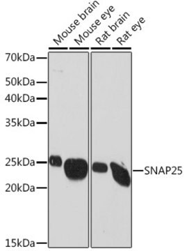 Anti-SNAP25 Antibody, clone 7Y9E3, Rabbit Monoclonal