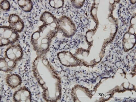 Monoclonal Anti-CHFR antibody produced in mouse clone 1H3-A12, purified immunoglobulin, buffered aqueous solution