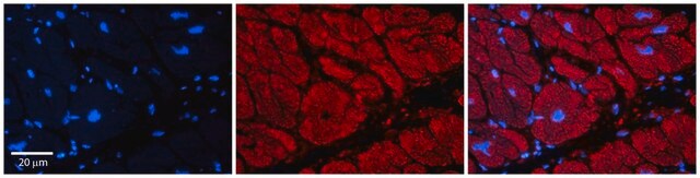 Anti-TRIM39 antibody produced in rabbit affinity isolated antibody