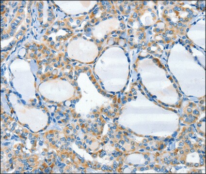 Anti-HID1 antibody produced in rabbit affinity isolated antibody