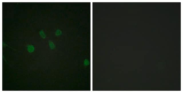 Anti-MAD1 antibody produced in rabbit affinity isolated antibody