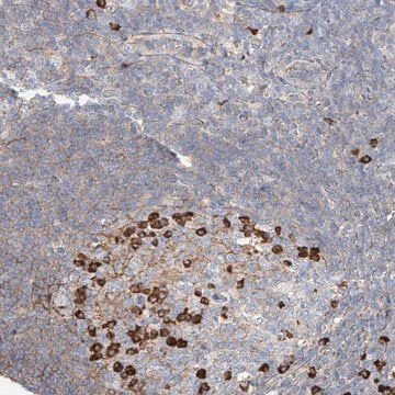 Anti-ZFP30 antibody produced in rabbit Prestige Antibodies&#174; Powered by Atlas Antibodies, affinity isolated antibody, buffered aqueous glycerol solution