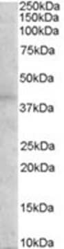 Anti-Melanocortin 3 Receptor antibody produced in goat affinity isolated antibody, buffered aqueous solution