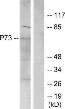 Anti-P73, N-Terminal antibody produced in rabbit affinity isolated antibody