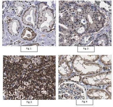 Anti-TRIM11 Antibody from rabbit, purified by affinity chromatography